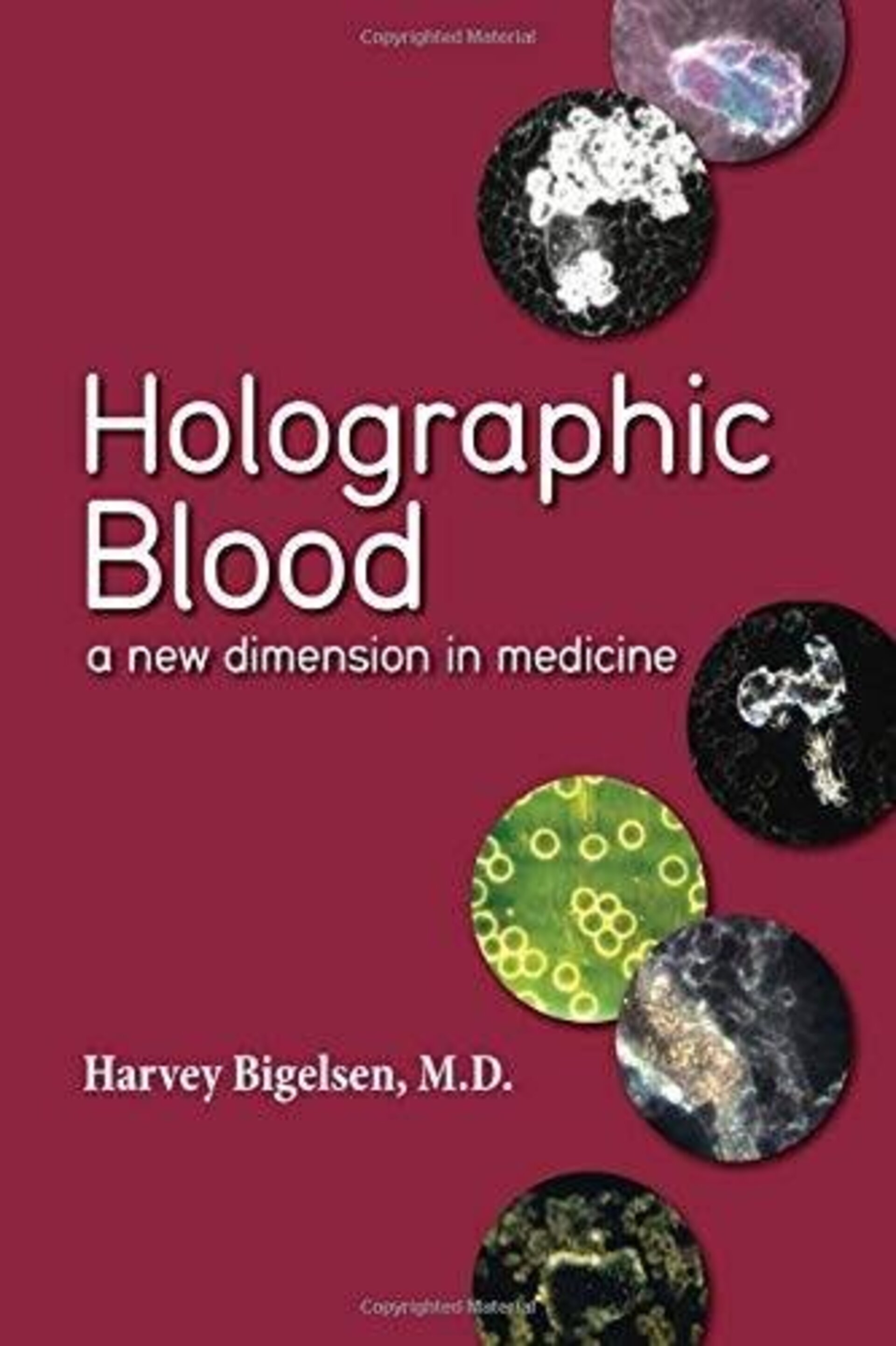 Holographic Blood, a new dimension in medicine - 1